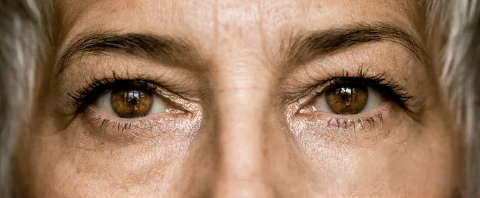 Glaucoma em mulheres: ligue o alerta! 