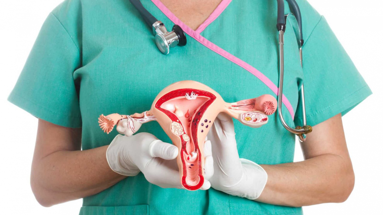 Endometriose Profunda Desafios e Avanços no Tratamento e Bem-Estar Feminino