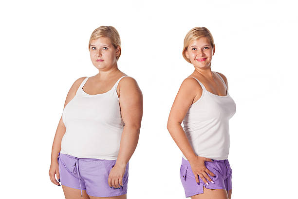 Cirurgia Bariátrica em Adolescentes é possível? Cirurgia Bariátrica em Adolescentes é possível?
