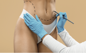 Tecnologia, definição e pioneirismo: como a laser lipo potencializa os resultados da lipo HD