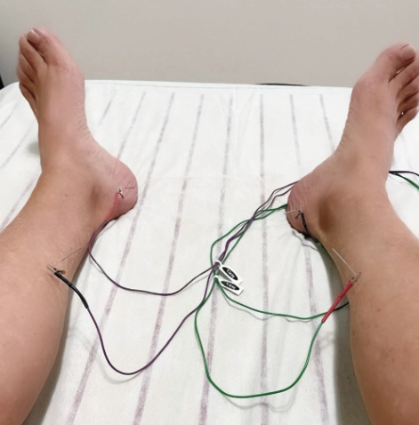 Neuromodulação: o cérebro no centro do cuidado