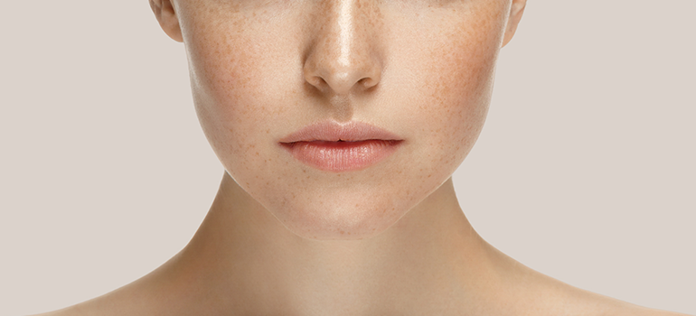 Rinoplastia: é possível ter o nariz dos sonhos? Rinoplastia: é possível ter o nariz dos sonhos?