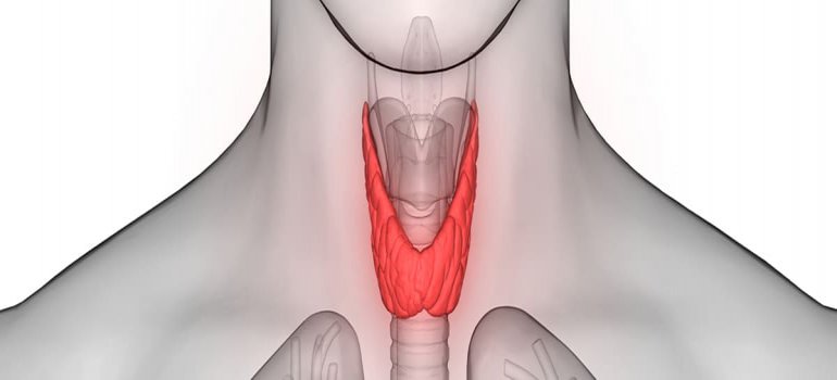 O Hipertireoidismo e a Doença de Graves O Hipertireoidismo e a Doença de Graves
