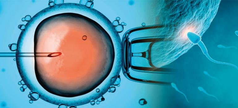 Fertilização In Vitro X Inseminação Intrauterina Fertilização In Vitro X Inseminação Intrauterina