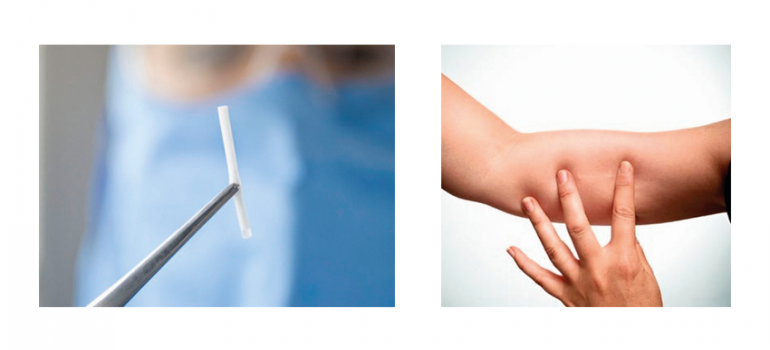 Contraceptivos de Longa Duração são mais Eficazes Contraceptivos de Longa Duração são mais Eficazes